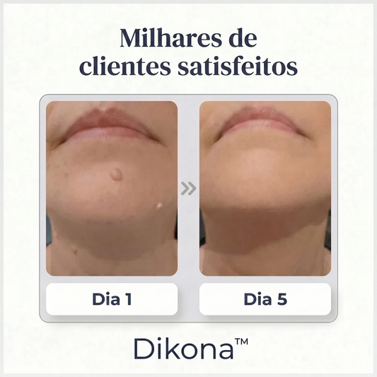 Patches DIKONA Anti-Imperfeição